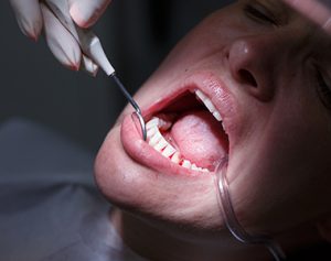 Facts you should know about Gum Disease