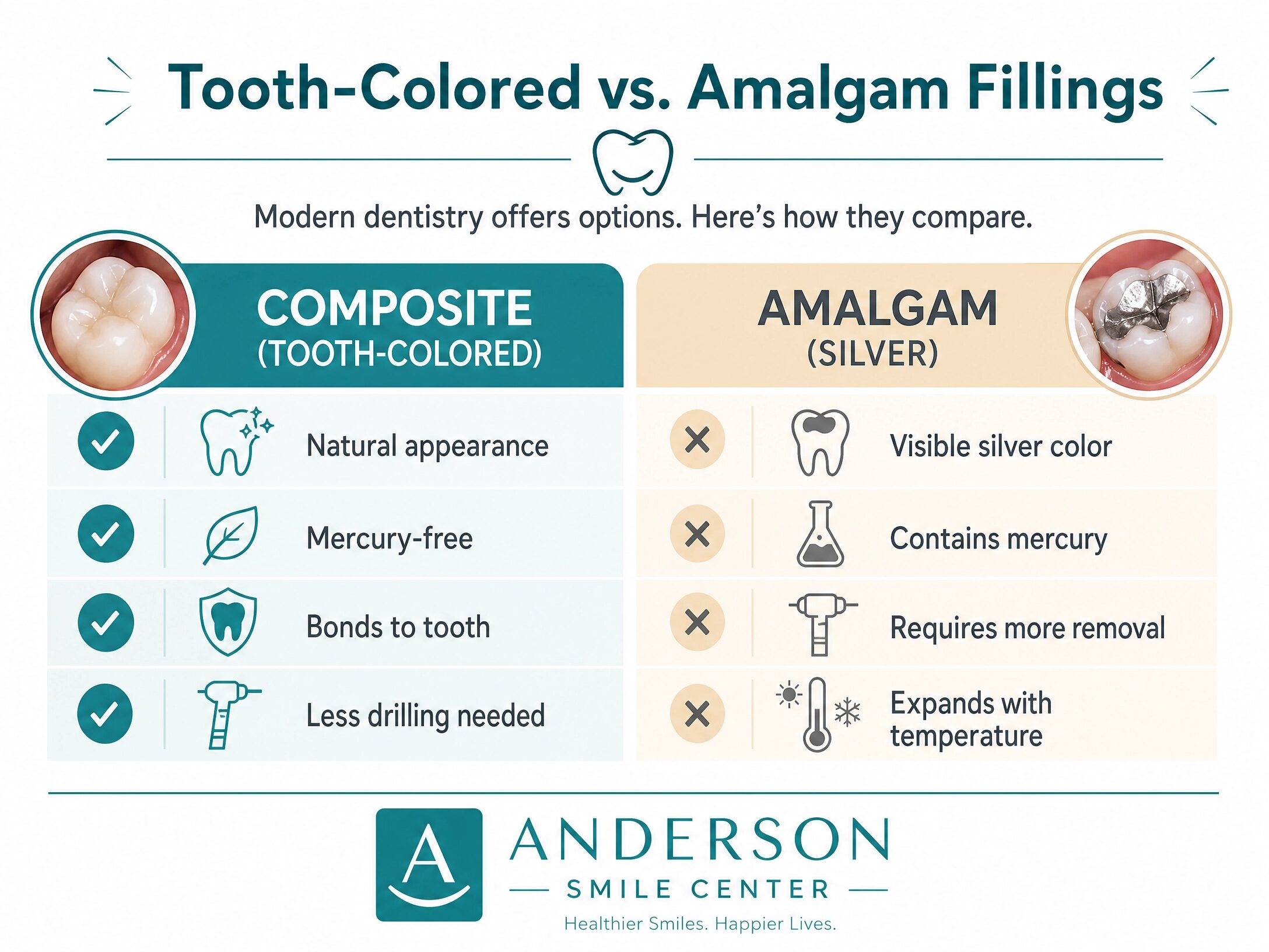 Infographic comparing tooth-colored composite fillings to silver amalgam fillings